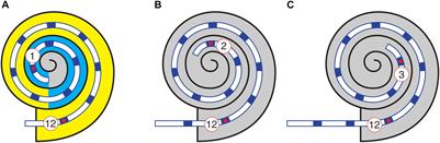 Exploiting Routine Clinical Measures to Inform Strategies for Better Hearing Performance in Cochlear Implant Users